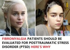 FIBROMYALGIA PATIENTS SHOULD BE EVALUATED FOR POSTTRAUMATIC STRESS DISORDER (PTSD) HERE’S WHY