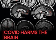 A major new study reveals that COVID-19 can cause measurable brain damage,