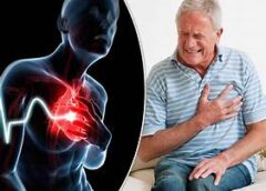 30 Important Signs That May Indicate a Heart Attack