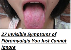 27 Invisible Symptoms of Fibromyalgia You Just Cannot Miss