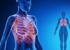 Fibromyalgia and Costochondritis: How They Are Connected