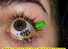 Fibromyalgia and Eye Problem How Fibromyalgia Affects Eyes