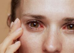 Dry eyes and mouth due to fibromyalgia