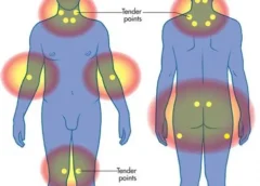 Do You Have Fibromyalgia? These 18 Tender Points Can Tell You