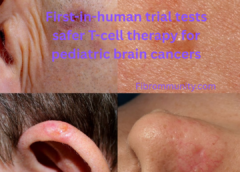 First-in-human trial tests safer T-cell therapy for pediatric brain cancers