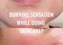 What Causes the Fibromyalgia Burning Sensation?