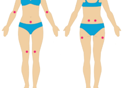 72 Symptoms of Fibromyalgia (Hard to Believe). What are yours?