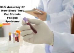 New Blood Test For Chronic Fatigue Syndrome Has 91% Accuracy