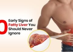 Fatty Liver Disease: Early Symptoms, Causes, Treatment & How to Reverse It Naturally