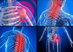 200+ Symptoms of Fibromyalgia What is Your