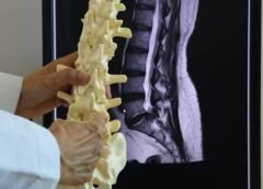 I have fibromyalgia and scoliosis with low back pain. Please explain my MRI findings.