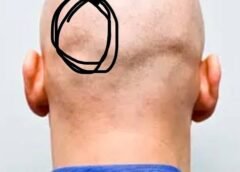 I Have Intense Pain in the Back of My Head. Is This Something Dangerous?