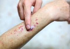 Persistent body pain is it leukemia or lymphoma?
